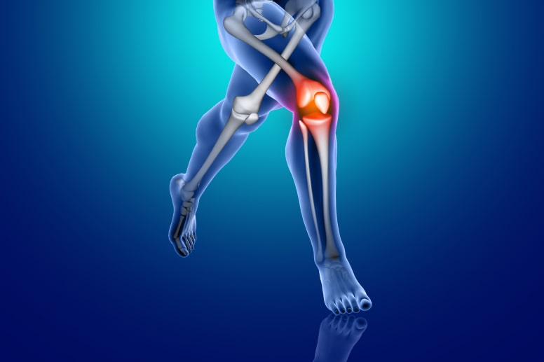 Болезнь Кенига коленного сустава: диагностика и лечение