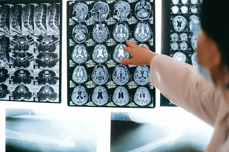 МРТ головного мозга: показания, особенности процедуры и ее стоимость