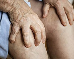 Артрит коленного сустава: симптомы и причины возникновения
