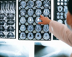 МРТ головного мозга: показания, особенности процедуры и ее стоимость